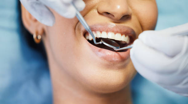 Best Emergency Root Canal Treatment in Louisburg, KS